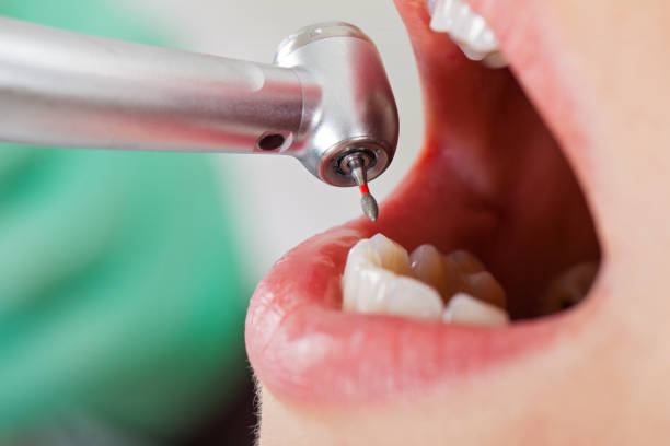 Best Urgent Tooth Repair  in Medford Lakes, NJ